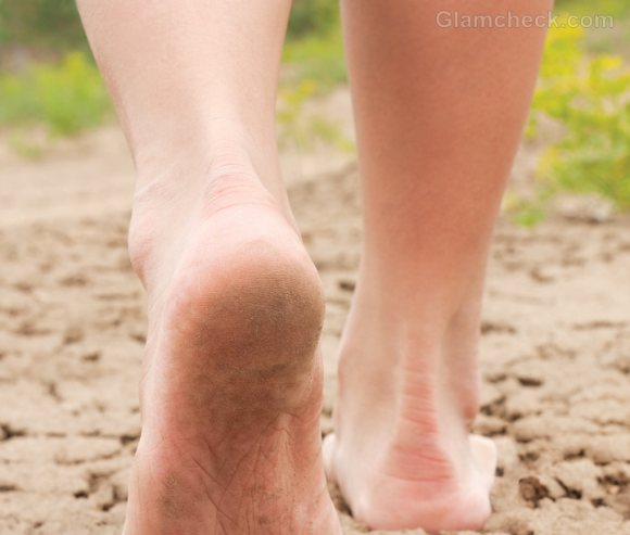 remedies for sore cracked heels
